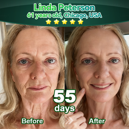 Stem Cell–Derived Purelora®  EGF & Copper Peptide Activating Serum  (Deeply activates skin renewal from within for firmer, smoother-looking skin)