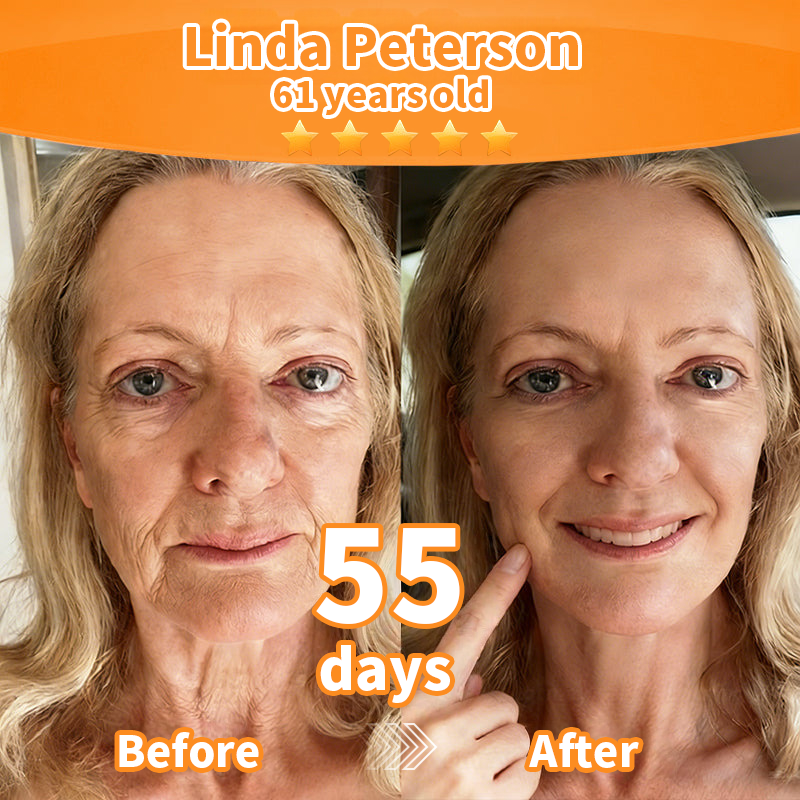 Purelora® Stem Cell Extract EGF and Copper Peptide Revitalizing Essence Cream (deeply activates the skin's internal regeneration, makes the skin firmer and smoother)