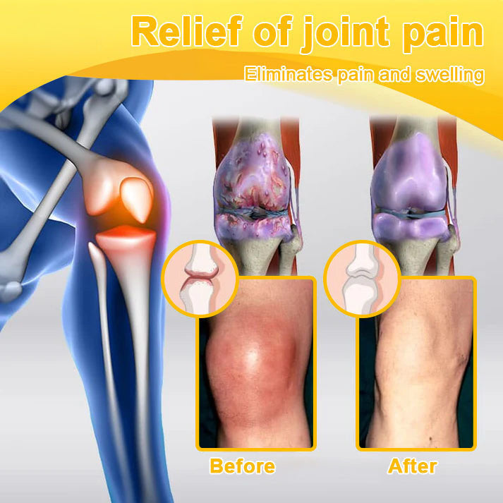Official U.S Store🇺🇸Purelora® Bee Venom Pain Relief Joint Repair Cream 🐝🐝(Fast Acting Pain Relief, Inflammation Reduction & Bone Support)