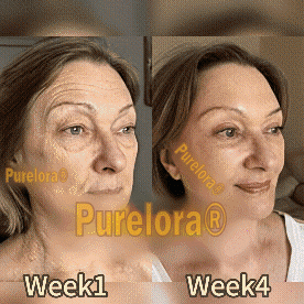 "Made and Shipped from America🔥|✅ Official Store✨Purelora® Bee Venom Skin Restorative Cream 🔥 LAST DAY 80% OFF 💎"