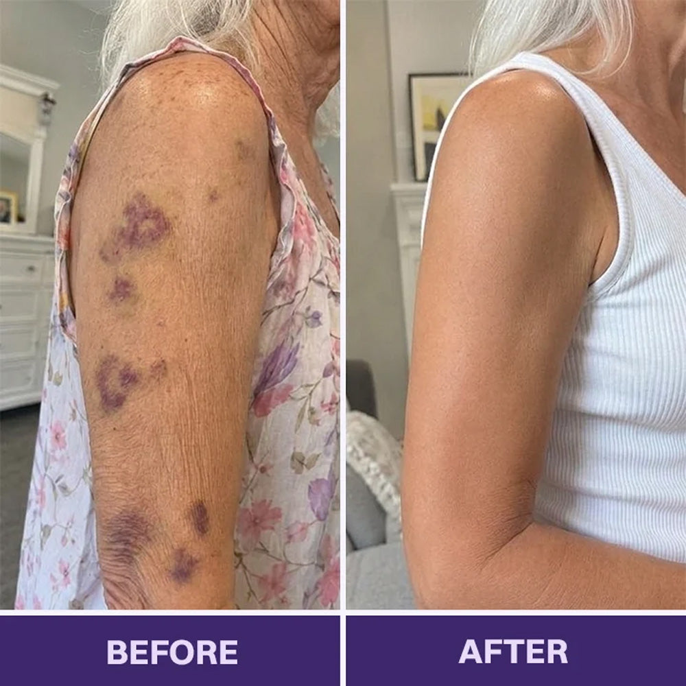 Purelora® Bruise Repair & Skin-Strengthening Cream
