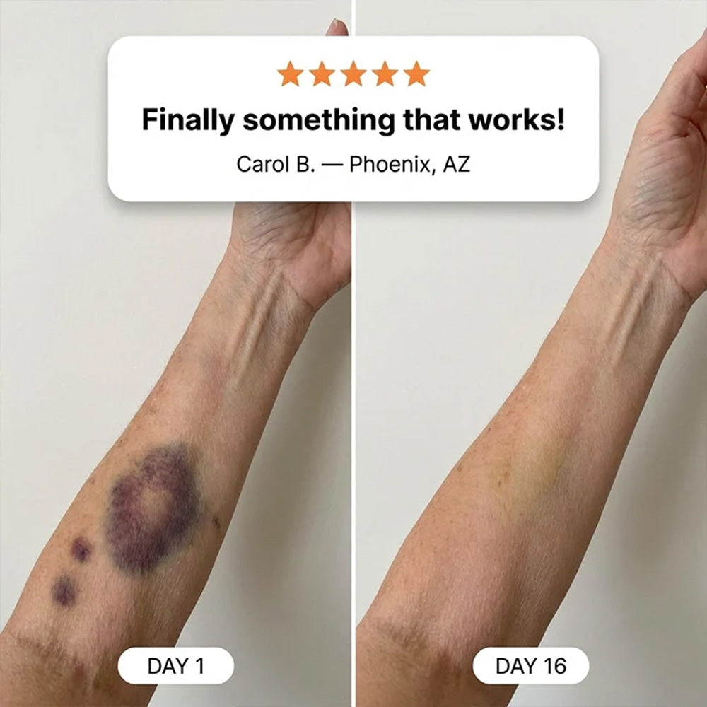 Purelora® Bruise Repair & Skin-Strengthening Cream