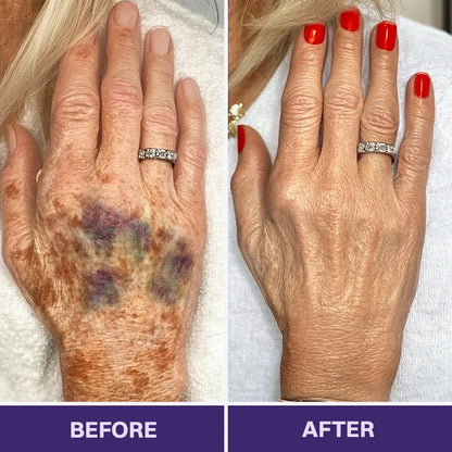 Purelora® Bruise Repair & Skin-Strengthening Cream