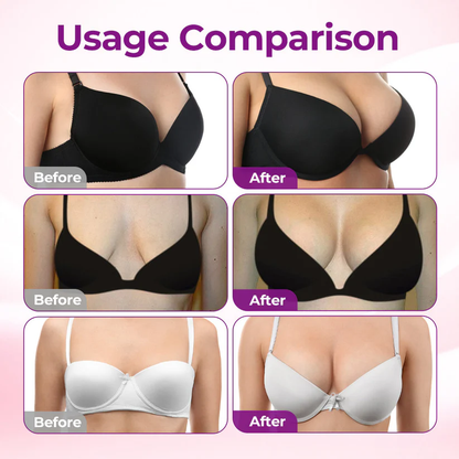 Purelora® Targeted Breast Enhancement Advanced Nano Microneedle Patch