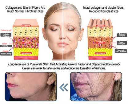 Purelora® Stem Cell Extract EGF and Copper Peptide Revitalizing Essence Cream (deeply activates the skin's internal regeneration, makes the skin firmer and smoother)