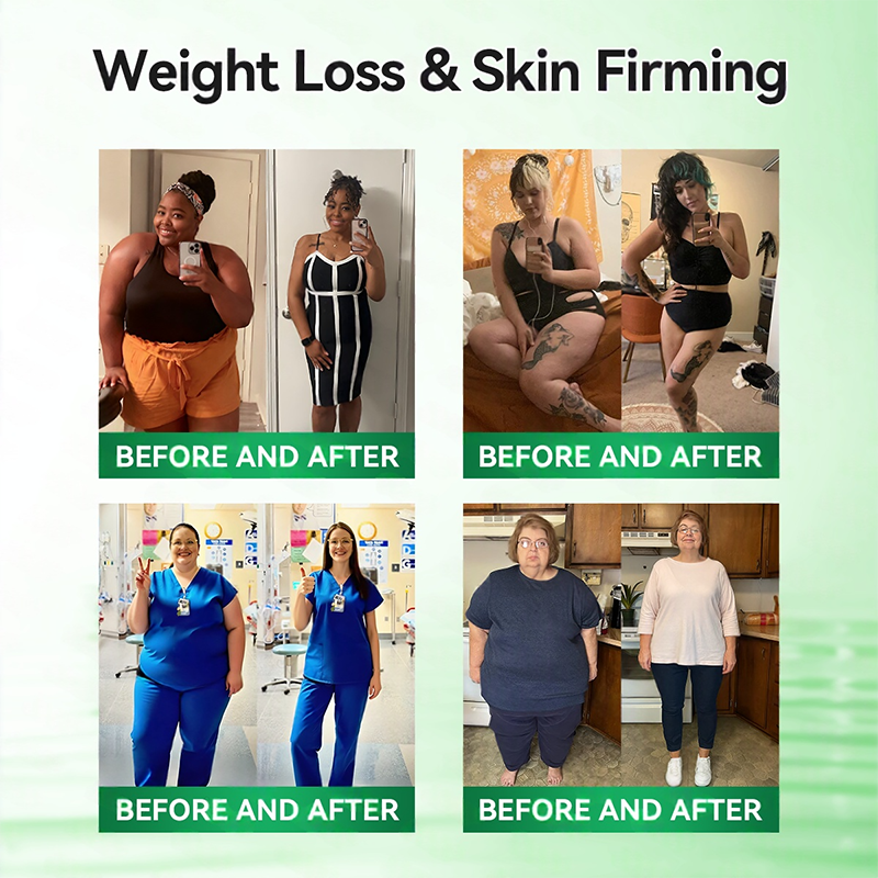 📢𝑶𝒇𝒇𝒊𝒄𝒊𝒂𝒍 𝑺𝒕𝒐𝒓𝒆  | 👩‍⚕️ H𝐞a𝐥r𝐢z𝐞® 1𝟐-𝐈N-1 M𝐨r𝐢n𝐠a * B𝐞r𝐛e𝐫i𝐧e * N𝐀D+ 𝐀d𝐯a𝐧c𝐞d N𝐚n𝐨 𝐌i𝐜r𝐨n𝐞e𝐝l𝐞 𝐏a𝐭c𝐡 (𝐎𝐧𝐜𝐞 𝐃𝐚𝐢𝐥𝐲, 𝐯𝐢𝐬𝐢𝐛𝐥𝐞 𝐜𝐡𝐚𝐧𝐠𝐞𝐬 𝐢𝐧 𝟕 𝐝𝐚𝐲𝐬） F𝐨r 𝐎𝐛𝐞𝐬𝐢𝐭𝐲, 𝐋o𝐨s𝐞 𝐒k𝐢n, 𝐃𝐢𝐚𝐛𝐞𝐭𝐞𝐬, 𝐒𝐥𝐞𝐞𝐩 𝐀𝐩𝐧𝐞𝐚, 𝐀𝐧𝐝 𝐉𝐨𝐢𝐧𝐭 𝐈𝐬𝐬𝐮𝐞𝐬🎁