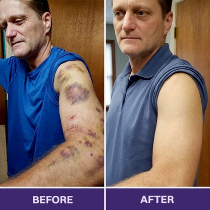 Purelora® Bruise Repair & Skin-Strengthening Cream