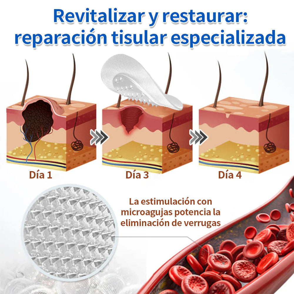 ✨Curalona® Parche 2 en 1 de Microneedles e Hidrocoloide🍀 | Elimina lunares elevados, acné, verrugas planas y fibromas cutáneos | Ayuda a mejorar arrugas, cicatrices e imperfecciones | Parches invisibles para rostro y cuerpo