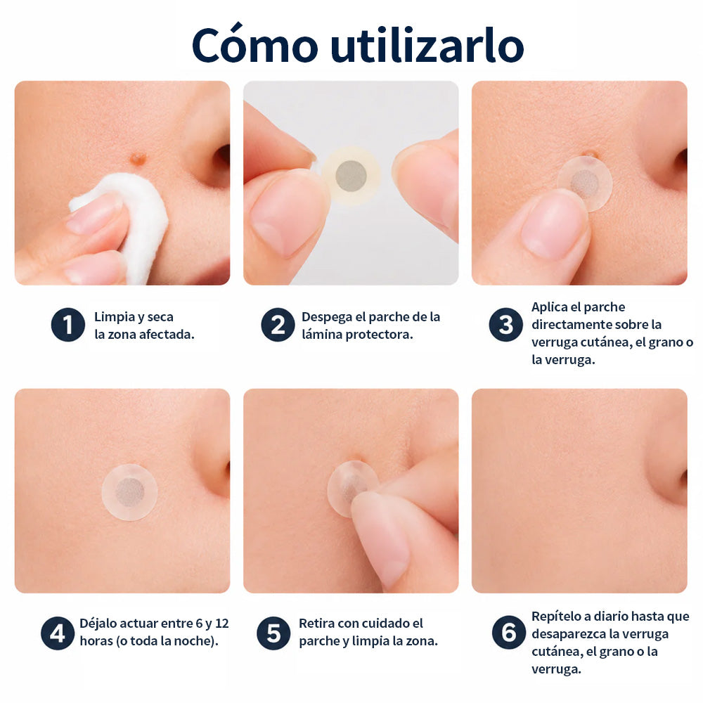 ✨Curalona® Parche 2 en 1 de Microneedles e Hidrocoloide🍀 | Elimina lunares elevados, acné, verrugas planas y fibromas cutáneos | Ayuda a mejorar arrugas, cicatrices e imperfecciones | Parches invisibles para rostro y cuerpo